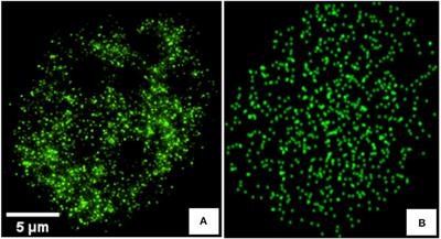 Detecting Differences of Fluorescent Markers Distribution in Single Cell Microscopy: Textural or Pointillist Feature Space?